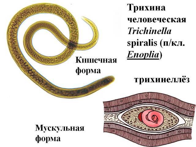 Трихинеллез и современная паразитология